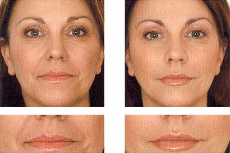 Tratamiento facial integral