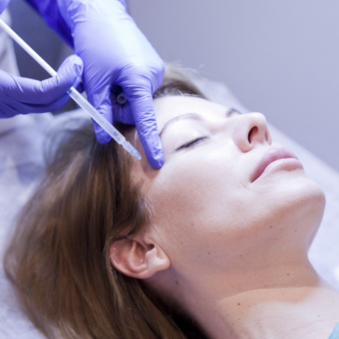 Remodelado facial con fillers